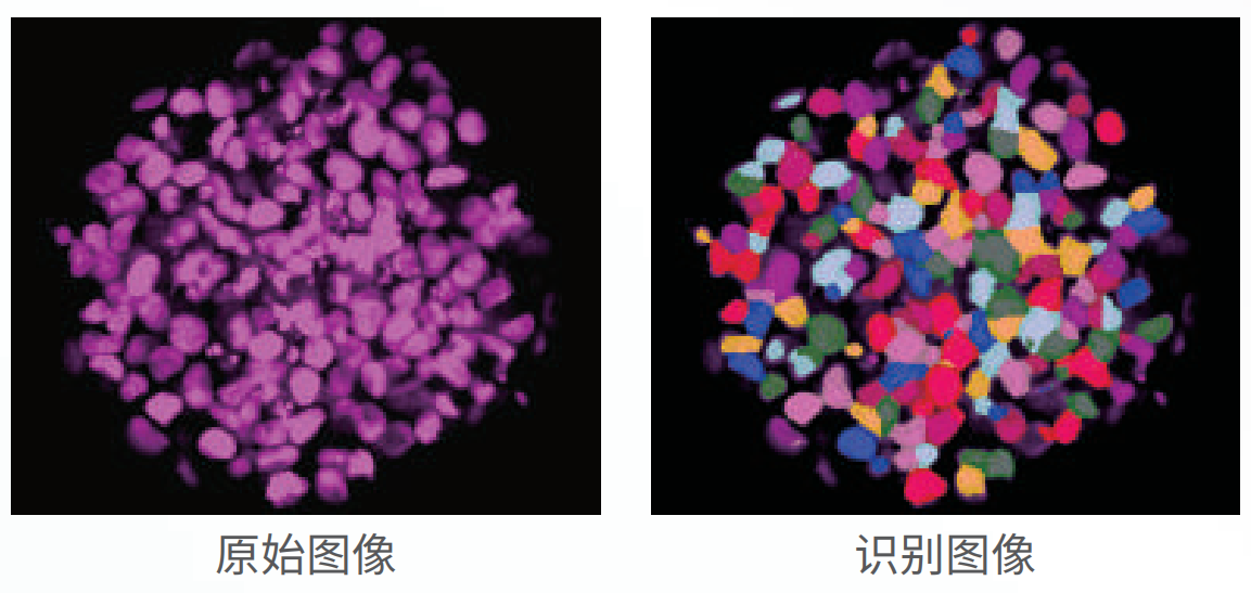 應(yīng)用3：類器官、球體成像.png